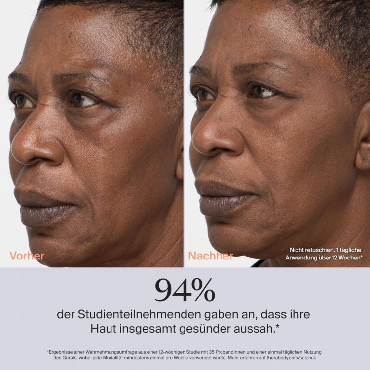 Therabody TheraFace PRO - ΛΕΥΚΟ/ΡΟΖ ΧΡΥΣΟ - TF02222-01